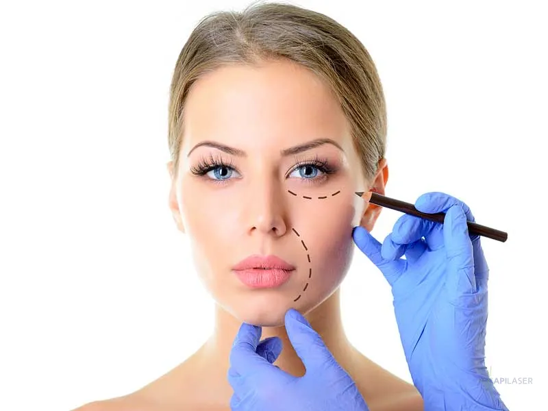 Ulthérapie - Ultrasons focalisés